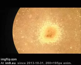 #Heart #Grew #Cells #Embryonic #Beating #Stem [Mildlyinteresting] some beating heart cells I grew from embryonic stem cells GIF (Изображение из альбом My r/MILDLYINTERESTING favs))