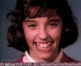 #Teeth #Correction #Timelapse timelapse-teeth-correction_20120701100629 GIF (Image of album Alternative-News.tk))