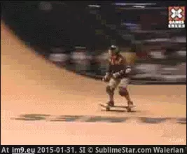 #Wtf #Hurts #Bet [Wtf] I bet this hurts GIF (Image of album My r/WTF favs))