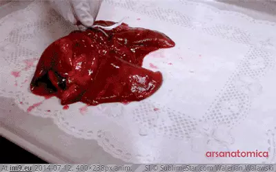 #Wtf #Cat #Inflating #Pair #Lungs [Wtf] Over-inflating a pair of cat lungs GIF (Image of album My r/WTF favs))