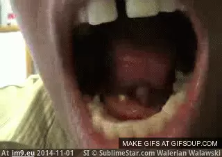 #Wtf #Guys #Tongue #Erupts #Pimple #Nsfl #Xpost #Popping [Wtf] Pimple under guys tongue erupts. Possible NSFL. (Xpost from r-popping) GIF (Изображение из альбом My r/WTF favs))