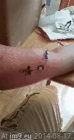 #Wtf #Mrsa #Tuesdays [Wtf] Tuesdays with MRSA 2 GIF (Obraz z album My r/WTF favs))