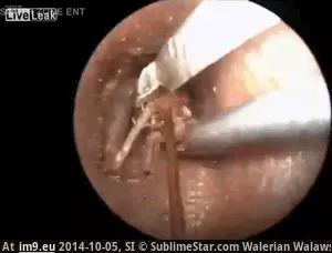 #Wtf #Wait #God #Fuck [Wtf] what..wait what the hell is.. OH GOD NO, FUCK NO! GIF (Imagen de album My r/WTF favs))
